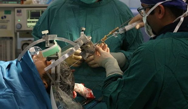 انجام عمل موفقیت آمیز جراحی تومور در شهرستان سقز